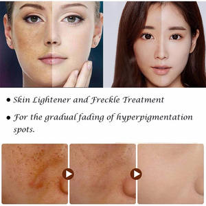 ODM-<span class=keywords><strong>crema</strong></span> blanqueadora facial para hombres y mujeres, <span class=keywords><strong>crema</strong></span> china de día y noche, antimanchas, rápida, 7 días, OEM, superventas - Product Image 5