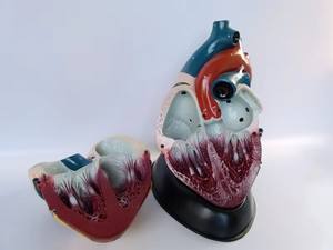 Ecógrafo Yulin YL2-30080 para el Departamento <span class=keywords><strong>de</strong></span> Cardiología del Hospital, para Uso Médico, Modelo <span class=keywords><strong>de</strong></span> Corazón Humano, Aumento <span class=keywords><strong>de</strong></span> 5X - Product Image 2