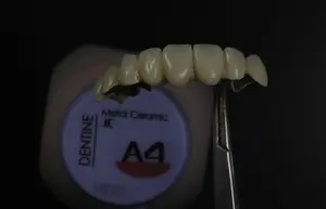 Baot Metaal Keramisch Dentine A1 A2 A3 Tandheelkunde Laboratorium Tandheelkundige Materialen Voor Behandeling Tandheelkundige Porselein Poeder Dentine 50G