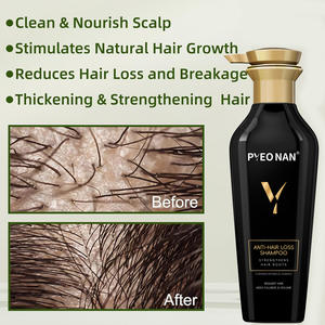 Champú <span class=keywords><strong>Natural</strong></span> y Orgánico a Base de Hierbas para el Cuidado del Cabello y la Caída del Cabello, con Jengibre y Cafeína, Anticaspa, Nutritivo, para el Crecimiento del Cabello, para Mujeres y Hombres - Product Image 3