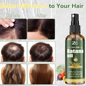 Aceite <span class=keywords><strong>de</strong></span> Batana para el Crecimiento del Cabello en Spray, Batana Cruda <span class=keywords><strong>de</strong></span> Honduras, Fortalece e Hidrata el Cabello Fino y Seco para Mujeres y Hombres - Product Image 3