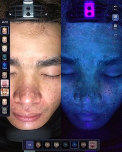 Equipo de belleza DJM Moreme 2023, Analizador de escáner de piel/VISIA, precio barato, análisis de piel Facial con tecnología IA - Product Image 4
