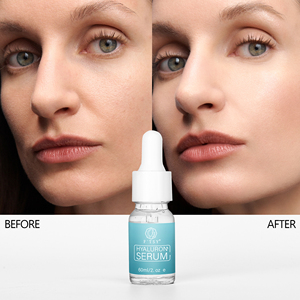 Sérum hydratant à l'aloe vera biologique, à l'acide hyaluronique, à la vitamine C et E, pour le visage, soin de la peau du visage, sérum à l'acide hyaluronique - Product Image 6
