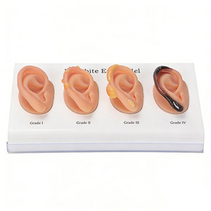 Maniquí DARHMMY para Demostrar las Etapas Progresivas de Congelación de las Orejas, de Leve a Severa, para Enseñanza Médica - Product Image 4