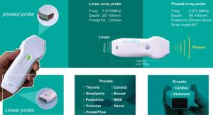 Escáner de sonda ultrasónica Veterinaria con matriz de fase WiFi y USB profesional para ultrasonido de sonda dual de mano de vasos sanguíneos cardíacos CU100 - Product Image 3