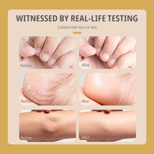 Nuova Crema Idratante per Mani e Piedi - Un <span class=keywords><strong>Essenziale</strong></span> Quotidiano di Tendenza per la Cura della Pelle Secca - Product Image 5