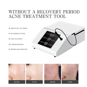 Dispositivo de Salón de Belleza Estilo Escritorio Coreano para el Tratamiento del Acné y Eliminación de Cicatrices, Equipo de Belleza para Uso Corporal y Doméstico - Product Image 3