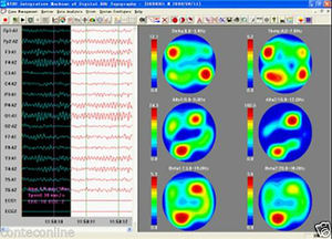 Sistema de <span class=keywords><strong>EEG</strong></span> Digital Portátil de 16 Canais, Máquina de <span class=keywords><strong>EEG</strong></span> - Product Image 6