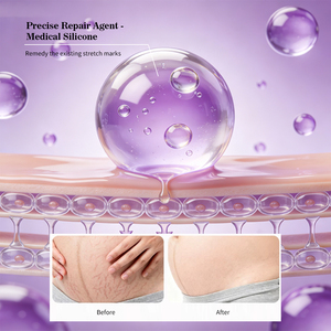 Beurre corporel anti-vergetures Mayfancy, réduit la visibilité des vergetures, soin de la peau pendant la grossesse, 120g - Product Image 3