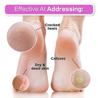 Liquide exfoliant pour les pieds 500 ml, éliminateur de callosités, adoucissant pour les pieds et les cuticules des ongles