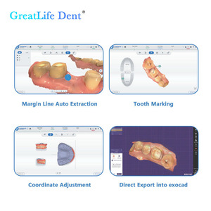 <span class=keywords><strong>Shining</strong></span> <span class=keywords><strong>3D</strong></span> Aoralscan L: Solución de Escaneo Digital Dental Optimizada en la Nube, Aleación de Aluminio Aeronáutico, 1 Año de Garantía, CE ISO - Product Image 5