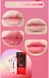Relleno Labial con Vitamina B12 Certificado por la CE, Gel Rojo <span class=keywords><strong>de</strong></span> Ácido Hialurónico Reticulado, Relleno Dérmico Inyectable para <span class=keywords><strong>Aumento</strong></span> <span class=keywords><strong>de</strong></span> <span class=keywords><strong>Labios</strong></span> - Product Image 3