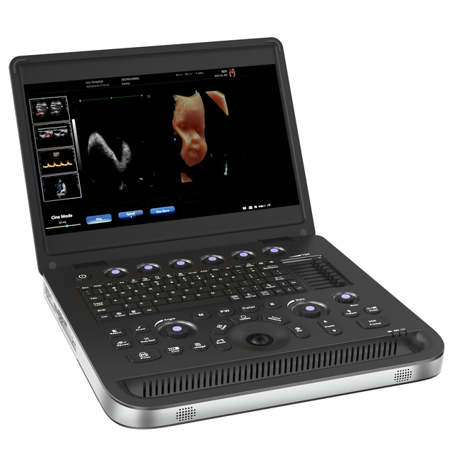 DMU71 Laptop Color Doppler Ultrasound with 15.6 Inch High Resolution 4D Echo Scanner Price for Human and Vet Use