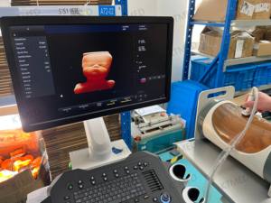 Échographe médical portable 4D 3D 2D, chariot, échographe couleur Doppler, scanner d'échographie diagnostique - Product Image 6