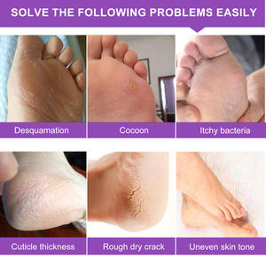 OEM Private Label Lavande Enlèvement Callosités Fissure Talon Exfoliant <span class=keywords><strong>Chaussette</strong></span> <span class=keywords><strong>Pied</strong></span> Masquage Peel Pour Pédicure Pieds Spa Peel <span class=keywords><strong>Masque</strong></span> Pieds - Product Image 2