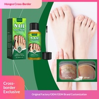 Solution réparatrice apaisante et nourrissante pour les ongles des orteils à base d'extraits végétaux naturels, avec une durée de conservation de 3 ans, 30 ml