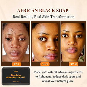 <span class=keywords><strong>Savon</strong></span> noir africain Luxfume, beurre de karité brut, végan, contrô<span class=keywords><strong>le</strong></span> du sébum, nettoyage en profondeur, hydratant, barre <span class=keywords><strong>pour</strong></span> une <span class=keywords><strong>peau</strong></span> éclatante, fait à la main, sans produits agressifs - Product Image 4