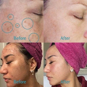 Suero Aclarante con Ácido Kójico en Oferta, Humectante Facial y Corporal, Nutritivo, Calmante, Potenciador de la Luminosidad, Cuidado Facial de la Piel - Product Image 4
