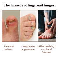 Traitement antifongique des ongles à l'huile d'arbre à thé et à l'aloe vera, solution réparatrice pour les ongles des pieds et des mains, restaure la santé des ongles