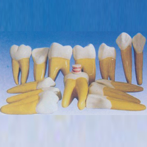 Modèle dentaire médical ADA pour adulte Sylloge (32 dents) – Modèle d'amplification dentaire (15 fois l'agrandissement) pour l'enseignement et l'apprentissage de l'anatomie Shanghai - Product Image 4