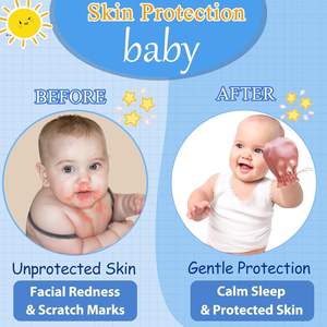 Étiquette personnalisée 100% mitaines d'eczéma en soie de mûrier pure pour bébés gants d'eczéma anti-rayures mitaines de soulagement de l'eczéma réglables - Product Image 4