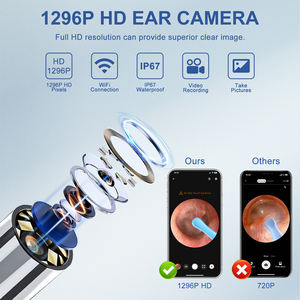 אלחוטי חכם שואב האוזן 1296p אולטרה אוזן מוט מוט מוט מוט אוטוסקופ - Product Image 5