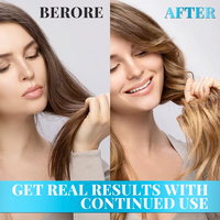 Serum Rambut Polygonum Ekstrak Herbal Perawatan Kulit Kepala Memperkuat Akar Rambut Mengurangi Kerontokan Perawatan Menutrisi Meningkatkan Kilau