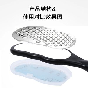 Callus Remover Stainless Steel Plastic Handle For Home Use 360 Degree Dead Skin Remover Foot Care Tool - Product Image 4