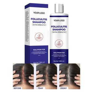 Champú Antifúngico 250ml Hidratante y Calmante de Uso Diario para Caspa y Cuero Cabelludo Graso - Product Image 6