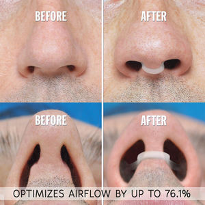 Dilator hidung silikon Anti mendengkur, klip hidung mudah bernapas, bantuan tidur untuk mendengkur & Rhinitis - Product Image 2