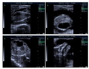 Mesin portabel pemindai kesehatan, sonografi diagnostik hewan pemeriksaan kekokografi pemindai Kesehatan - Product Image 4