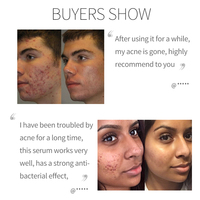 Sérum Visage Anti-Âge Hydratant Éclaircissant à l'Acide Hyaluronique et Vitamine C Bio, Acide Azélaïque 10% Liquide, Marque Blanche
