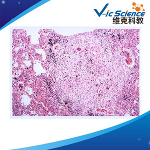 Il Laboratorio dell'Università Medica ha Preparato Vetrini Microscopici del Sistema Respiratorio Umano - Product Image 6