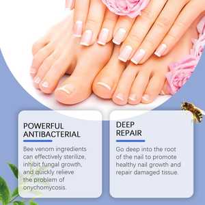 Solución Reparadora de Uñas con Veneno de Abeja de 50 ml para el Cuidado de Manos y Pies, FUNGUS DE UÑAS CON VENENO DE ABEJA - Product Image 5