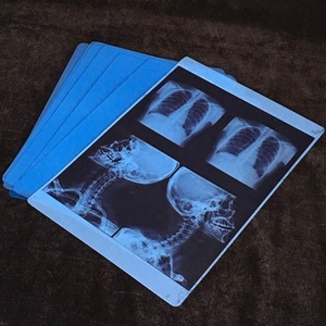Pellicole Blu per Radiografie Mediche, Fogli e Rotoli per Stampanti a Getto d'Inchiostro per Raggi X - Product Image 2