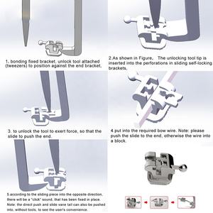 Ortodontik bukkal tüpler ile diş pasif <span class=keywords><strong>Roth</strong></span> 022 kendinden bağlayıcı parantez - Product Image 5
