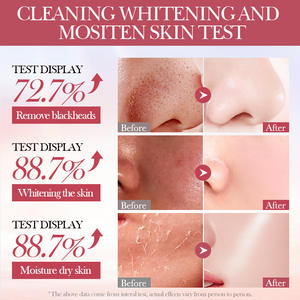 BIOAQUA masque d'argile bio bâton rose Rose visage boue argile nettoyage en profondeur hydrater masque facial pour l'acné <span class=keywords><strong>points</strong></span> <span class=keywords><strong>noirs</strong></span> grands Pores - Product Image 6