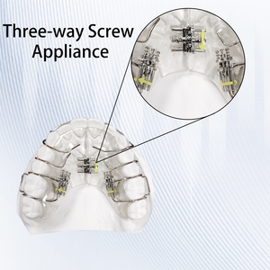 Vis orthodontique à trois voies <span class=keywords><strong>pour</strong></span> <span class=keywords><strong>appareil</strong></span> <span class=keywords><strong>dentaire</strong></span>, destinée à l'expansion de la voie <span class=keywords><strong>dentaire</strong></span> étroite et à la distalisation des molaires en malocclusion de classe II - Product Image 4