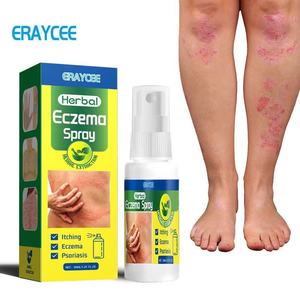 Spray Erboristico Biologico per Eczema, Psoriasi e Dermatite, Lenitivo ad Azione Rapida, Anti-Infiammatorio, Spray per la Cura della Pelle 30ml - Product Image 2