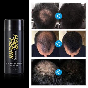 Fibres de renforcement des <span class=keywords><strong>cheveux</strong></span> OEM <span class=keywords><strong>racine</strong></span> retouche les <span class=keywords><strong>cheveux</strong></span> clairsemés pour femmes 25g - Product Image 5