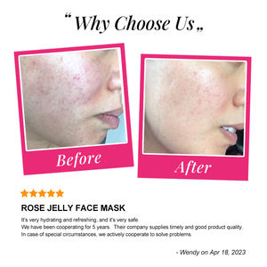 <span class=keywords><strong>Gelée</strong></span> hydratante et <span class=keywords><strong>éclaircissante</strong></span> personnalisée avec logo SPA, soin de la peau, ginseng, ganoderma, AHA, arbutine, acide hyaluronique, acide kojique, vitamine C - Product Image 5