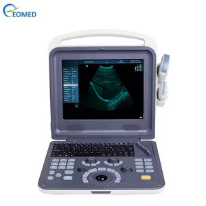 पोर्टेबल रंग डॉपलर नैदानिक अल्ट्रासाउंड स्कैनर चिकित्सा अल्ट्रासाउंड मशीन क्यू28 - Product Image 1
