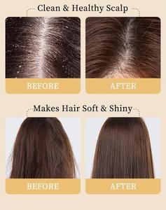 Set per la Crescita dei Capelli Biologico all'Ingrosso, Shampoo e Balsamo Naturale al Ginger Anticaduta OEM - Product Image 4