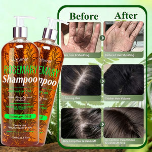 <span class=keywords><strong>Shampoo</strong></span> al Rosmarino Delicato per Pulizia Profonda, Nutrimento, Riparazione Cuticole, Lenitivo per il Cuoio Capelluto, Anti-Caduta - Product Image 6