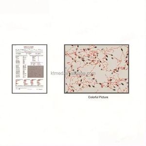 Analyseur de sperme KTMED, analyseur de sperme automatique portable, <span class=keywords><strong>microscope</strong></span> pour sperme bovin, analyseur de sperme vétérinaire pour chiens - Product Image 5