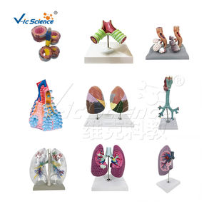 Ciencia Médica lesión de próstata humana modelo anatómico el modelo de educación enferma de próstata - Product Image 6