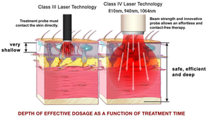 Equipo de Fisioterapia Láser de Rehabilitación para Mascotas y Humanos de Clase IV de Alta Calidad para el Alivio del Dolor - Product Image 2
