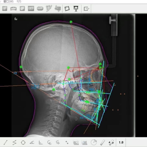 Appareil de radiographie <span class=keywords><strong>panoramique</strong></span> et céphalométrique <span class=keywords><strong>numérique</strong></span> <span class=keywords><strong>dentaire</strong></span> à technologie éprouvée - Product Image 4