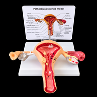 Modèle d'ovaire, modèle anatomique de l'organes reproducteurs féminins, outil éducatif médical