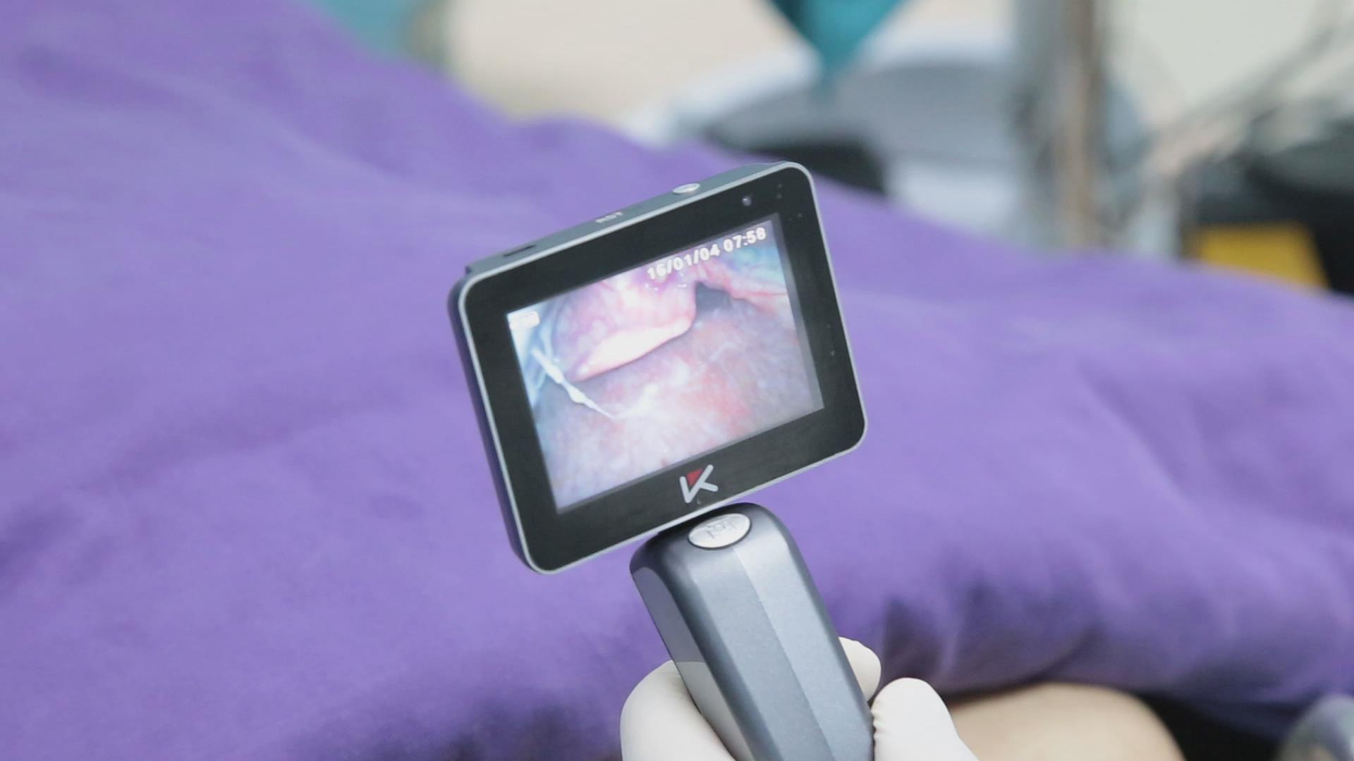 3" TFT OLED Surgical Handheld Video Laryngoscope 18650 Rechargeable